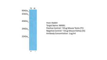 NR0B1 antibody