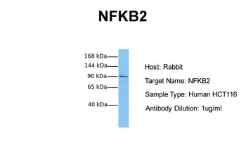 NFKB2 antibody