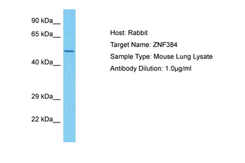 ZFP384 antibody