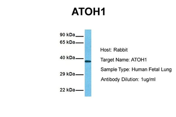 ATOH1 antibody