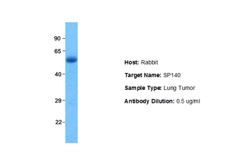 SP140 antibody