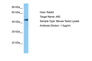 ATF2 antibody