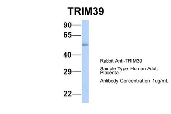 TRIM39 antibody