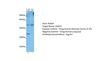 VDAC1 antibody