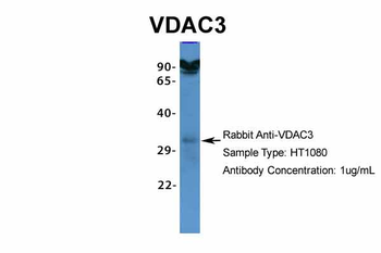 VDAC3 antibody