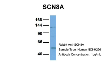 SCN8A antibody
