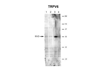 Trpv6 antibody
