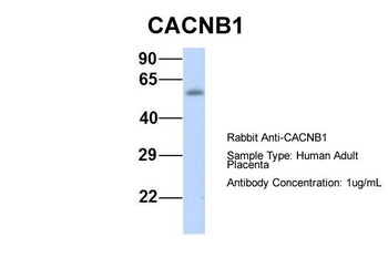 CACNB1 antibody