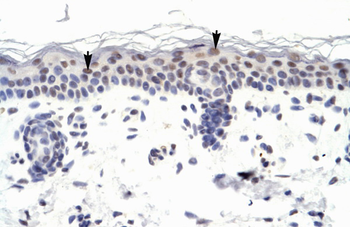 ZNF223 antibody