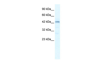 SP140L antibody