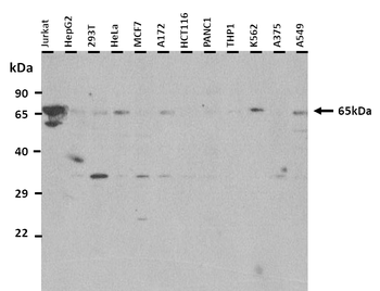 TBX18 antibody