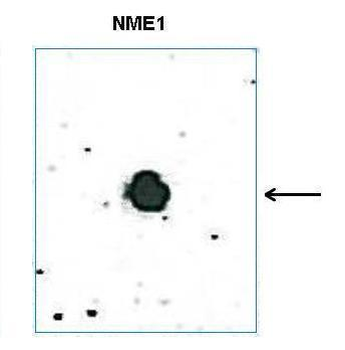 Nme1 antibody