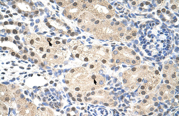 RNF14 antibody