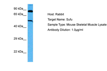 SUFU antibody