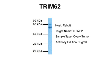 TRIM62 antibody