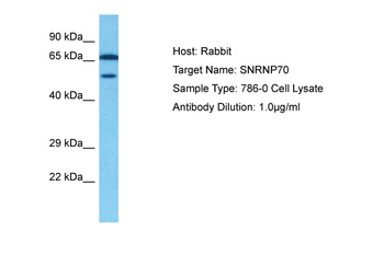 SNRP70 antibody