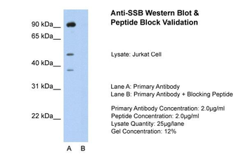 SSB antibody