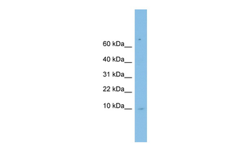 LSM6 antibody