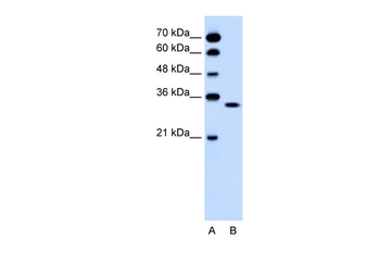 OR5T2 antibody