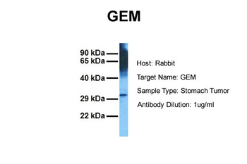 GEM antibody