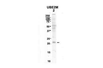 UBE2M antibody