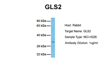 GLS2 antibody