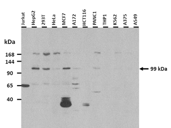 MTTP antibody