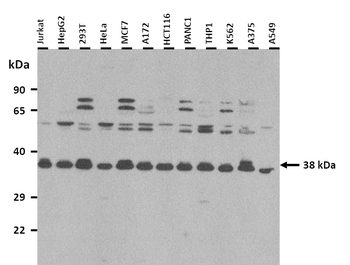 EFNB1 antibody