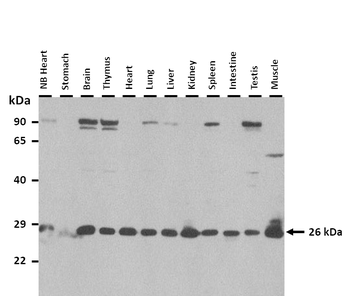 Clec1b antibody