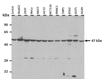 A4GALT antibody