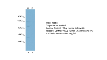 A4GALT antibody