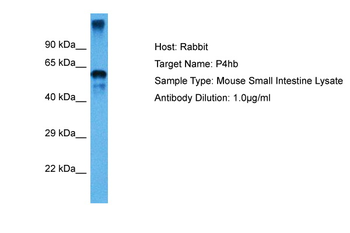 P4HB antibody