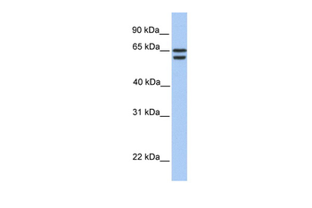 CDYL2 antibody