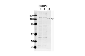 RBBP8 antibody