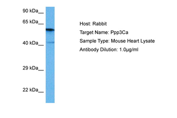 PPP3CA antibody