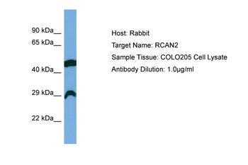 RCAN2 antibody