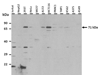 ALAS1 antibody