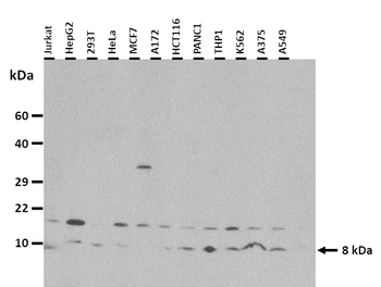 FAU antibody