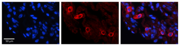 GRK5 antibody