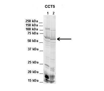 CCT5 antibody