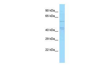 TBC1D22A antibody