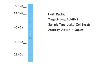 ALKBH3 antibody