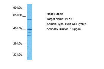 PTX3 antibody