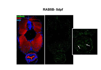 RAB5B antibody