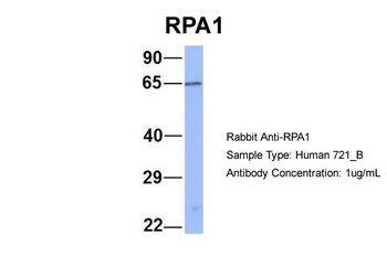 RPA1 antibody