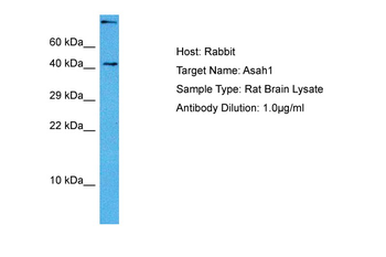 ASAH1 antibody