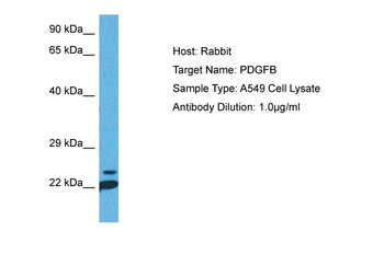 PDGF B antibody