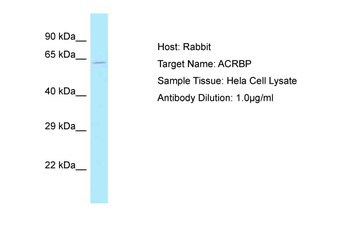 ACRBP antibody