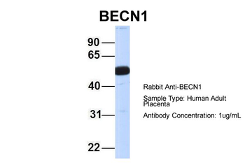 Beclin 1 antibody