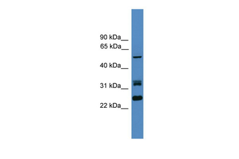 LRRFIP2 antibody